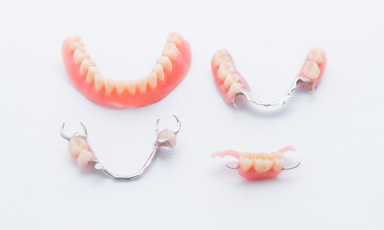 Various replacement options exist for patients with missing teeth, each with its unique benefits and considerations.